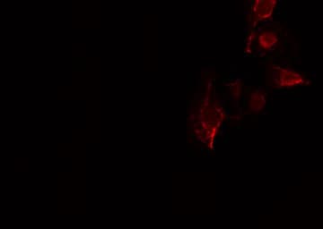 Polyclonal Rabbit anti-Human YOD1 Antibody (IF, WB)