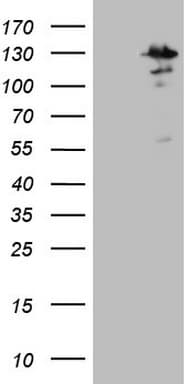 Monoclonal Mouse anti-Human MTF-1 Antibody (clone OTI2F3, aa1-272, IHC, WB)