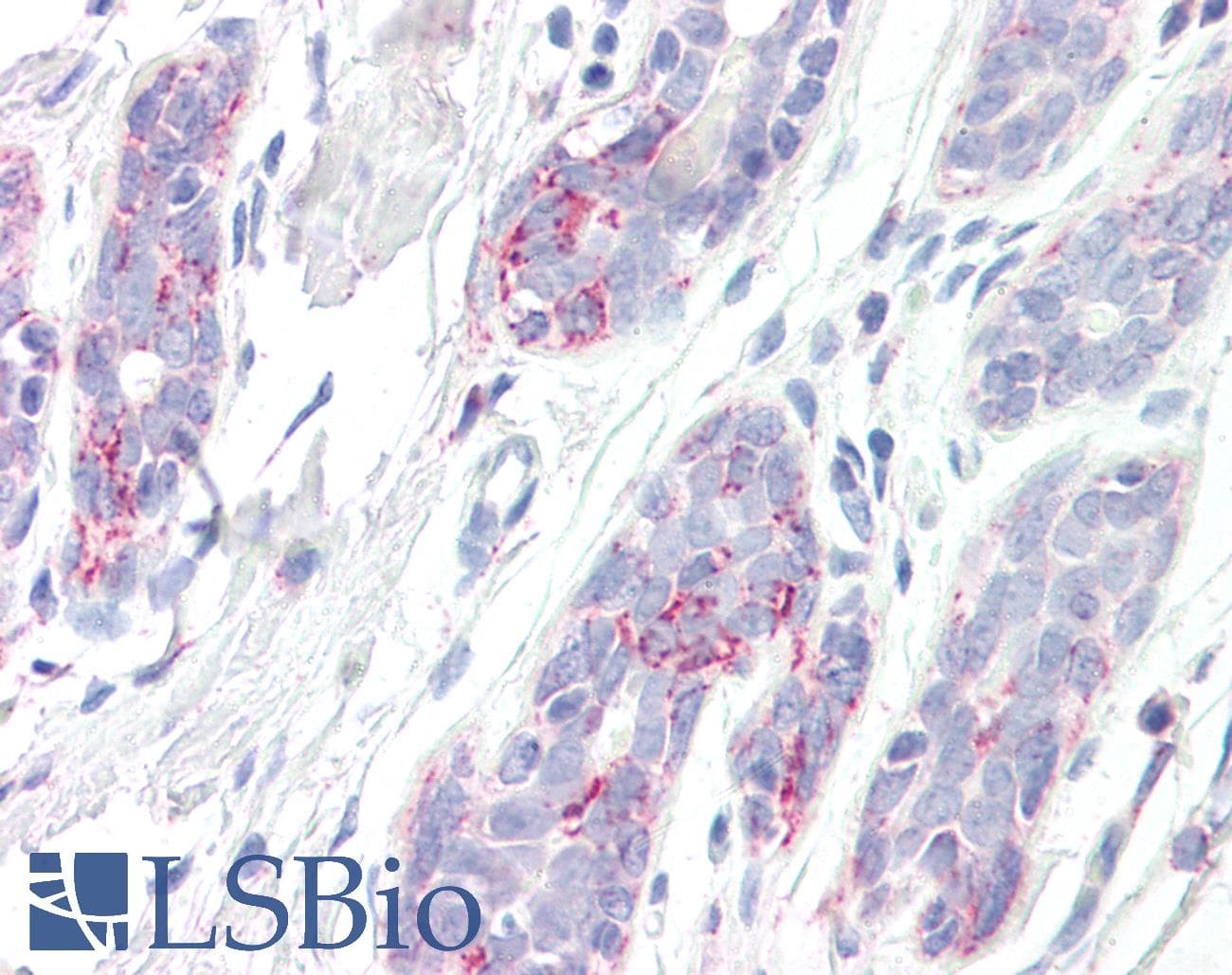 IHC-plus™ HSD17B10 / HADH2 Antibody (aa242-252)