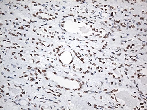 EWSR1 / EWS Antibody (aa256-447, clone OTI3F6, Carrier-free)