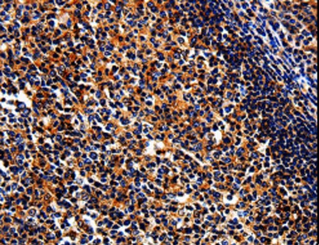 Polyclonal Rabbit anti-Human BRUCE / BIRC6 Antibody (IHC)