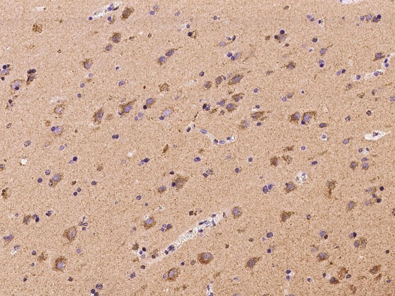 IGF2R / CD222 Antibody
