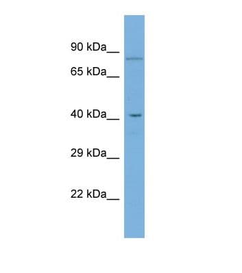 GDPD5 Antibody (aa203-252)
