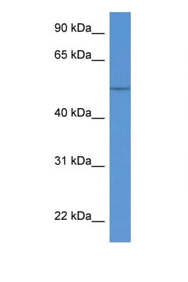 Polyclonal Rabbit anti-Human KRT36 / Keratin 36 / KRTHA6 Antibody (aa147-196, WB)