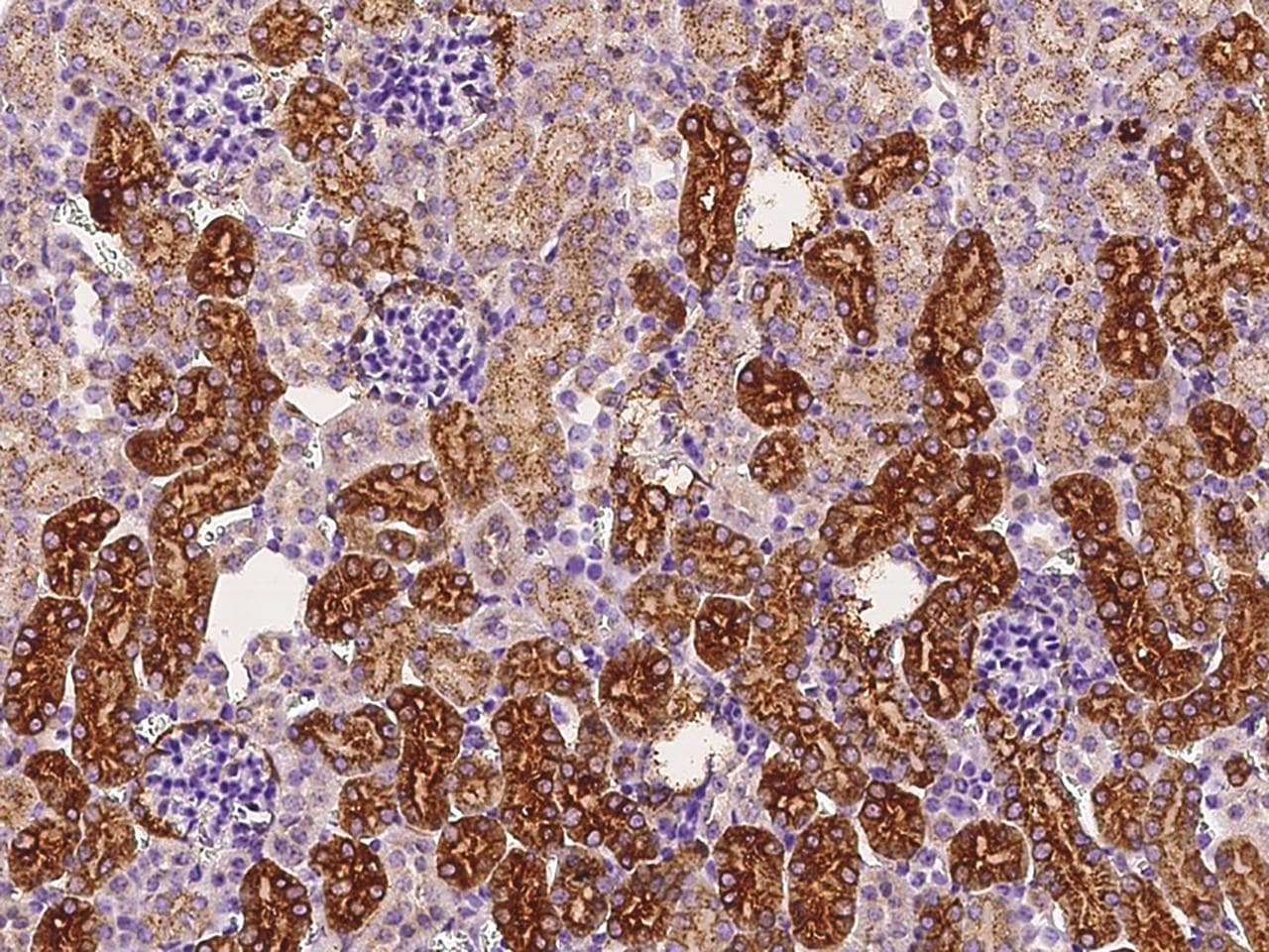 Polyclonal Rabbit anti-Mouse CTSL / Cathepsin L Antibody (Preservative Free, IHC)
