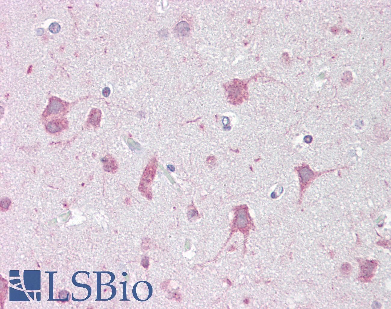 IHC-plus™ Polyclonal Rabbit anti-Human GABRA1 Antibody (IHC, WB)