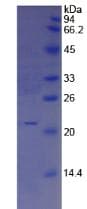 Human IL25 / IL17E Protein (Recombinant His, N-Terminal)