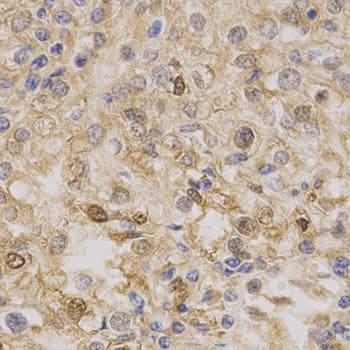 PRKAA1 / AMPK Alpha 1 Antibody