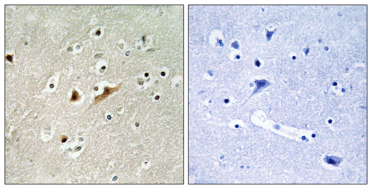 RACGAP1 / MGCRACGAP Antibody (aa31-80)