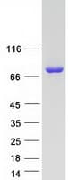 Human SHKBP1 Protein (Recombinant Myc-DDK (Flag))