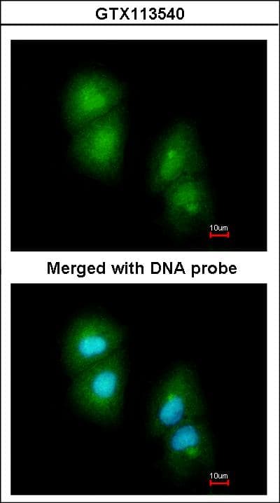Polyclonal Rabbit anti-Human RGS13 Antibody (aa1-159, WB)