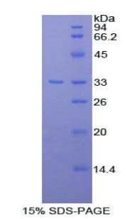 Rat SERPINA7 / TBG Protein (Recombinant His)