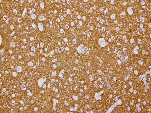 VILIP / VSNL1 Antibody (aa2-191, clone UMAB116, Carrier-free)
