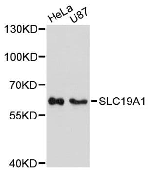 Polyclonal Rabbit anti-Human SLC19A1 Antibody (WB)
