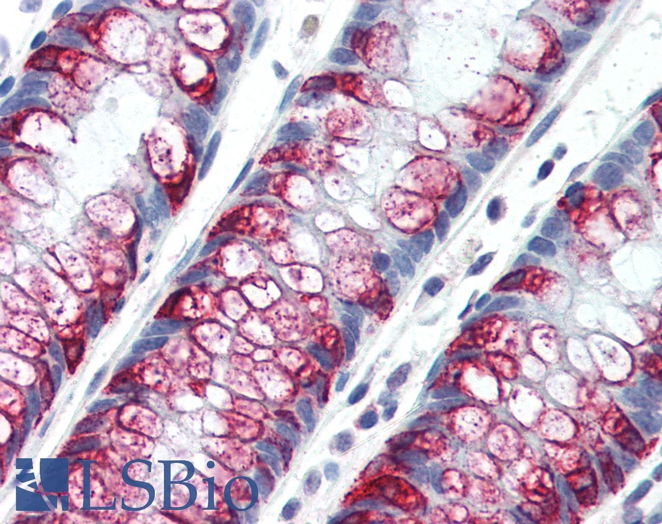 IHC-plus™ Mucin 2 / MUC2 Antibody (clone SPM512)