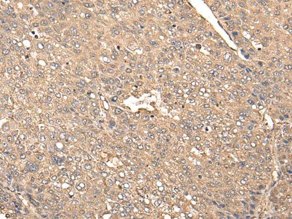 Polyclonal Rabbit anti-Human BDH2 Antibody (IHC, WB)