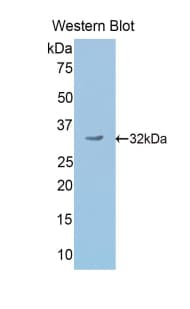 SCG2 / Secretogranin II Antibody (aa342-609)