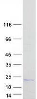 Human Spondyloepiphyseal dysplasia, late, pseudogene (SEDLP) Protein (Recombinant Myc-DDK (Flag))