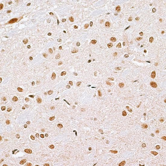 CBX6 Antibody