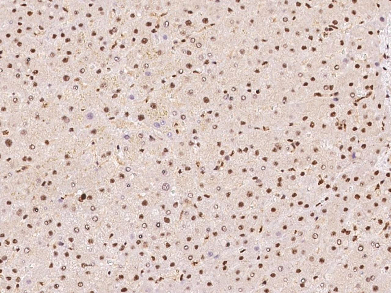 DDX46 Antibody