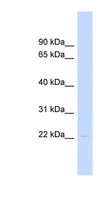 HAND1 Antibody (aa35-84)