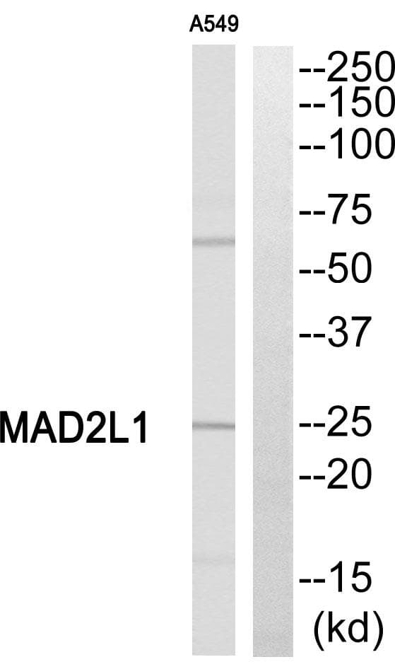 Polyclonal Rabbit anti-Human MAD2L1 / MAD2 Antibody (WB)