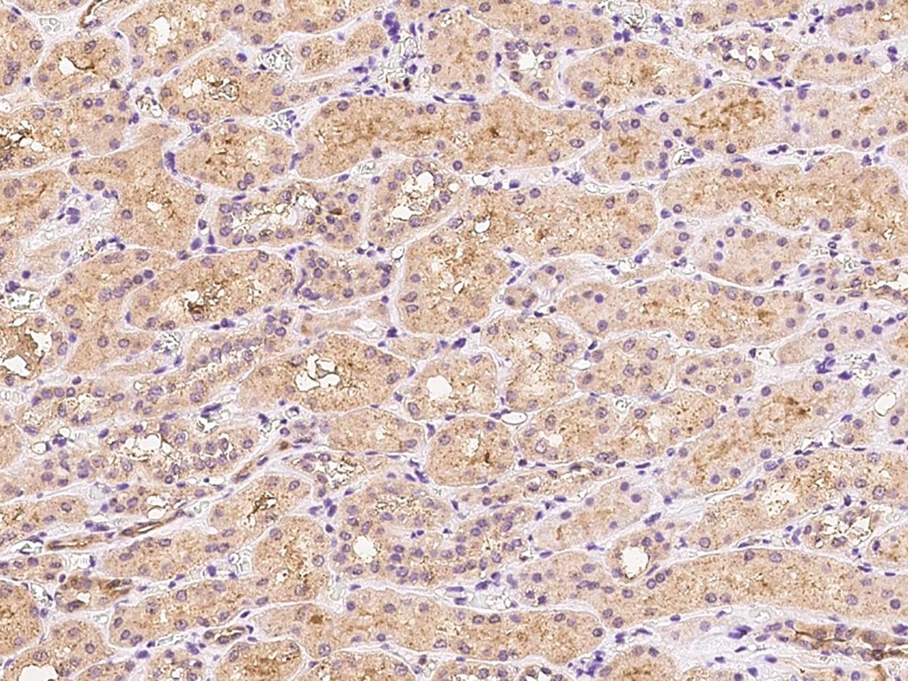 TNFRSF13B / TACI Antibody