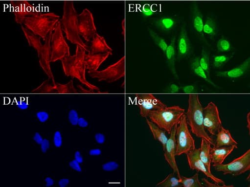 ERCC1 Antibody (clone 4F9)