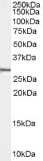 IHC-plus™ SDCBP / Syntenin Antibody (aa6-19)