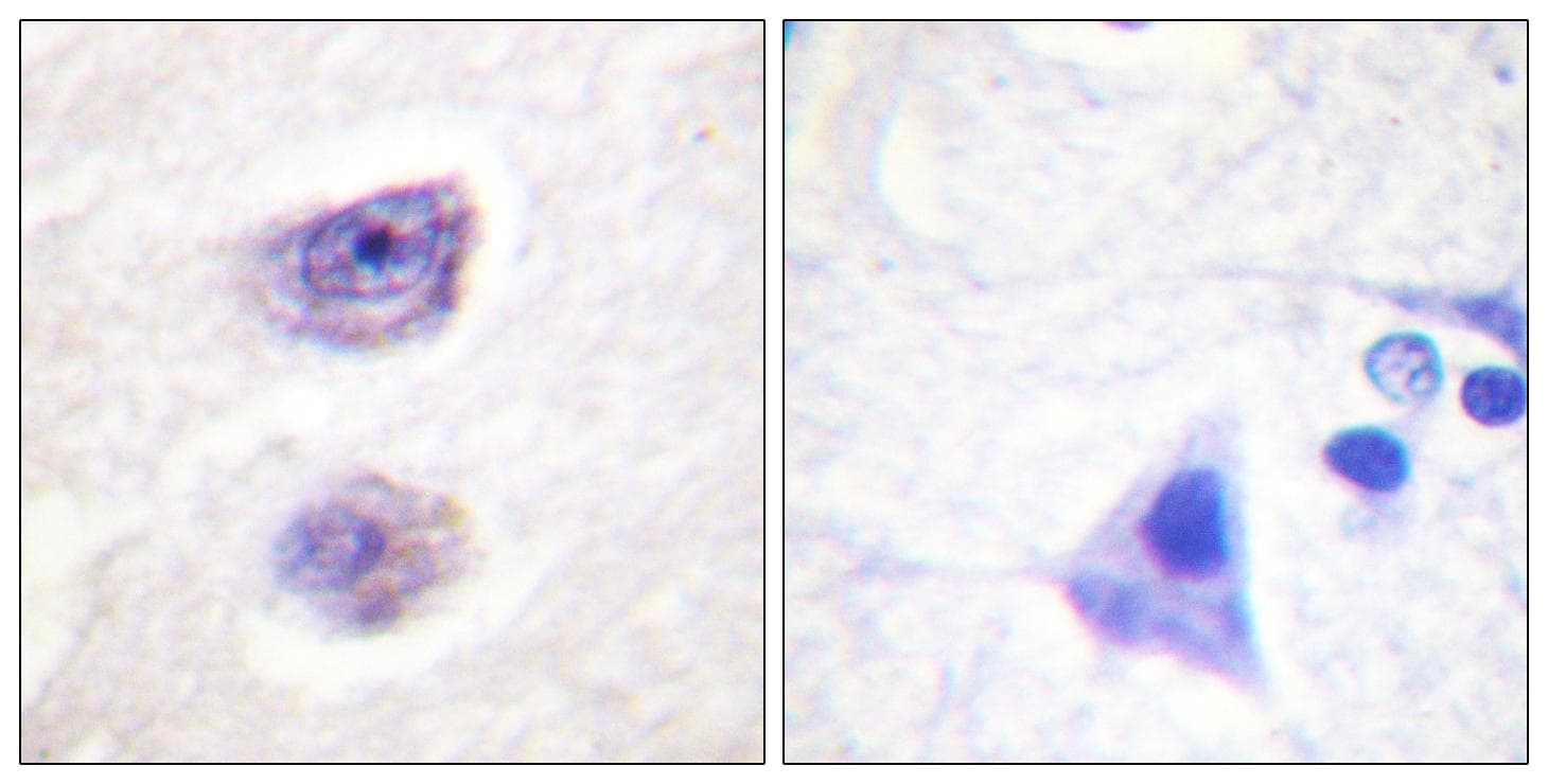 TH / Tyrosine Hydroxylase Antibody (phospho-Ser8)
