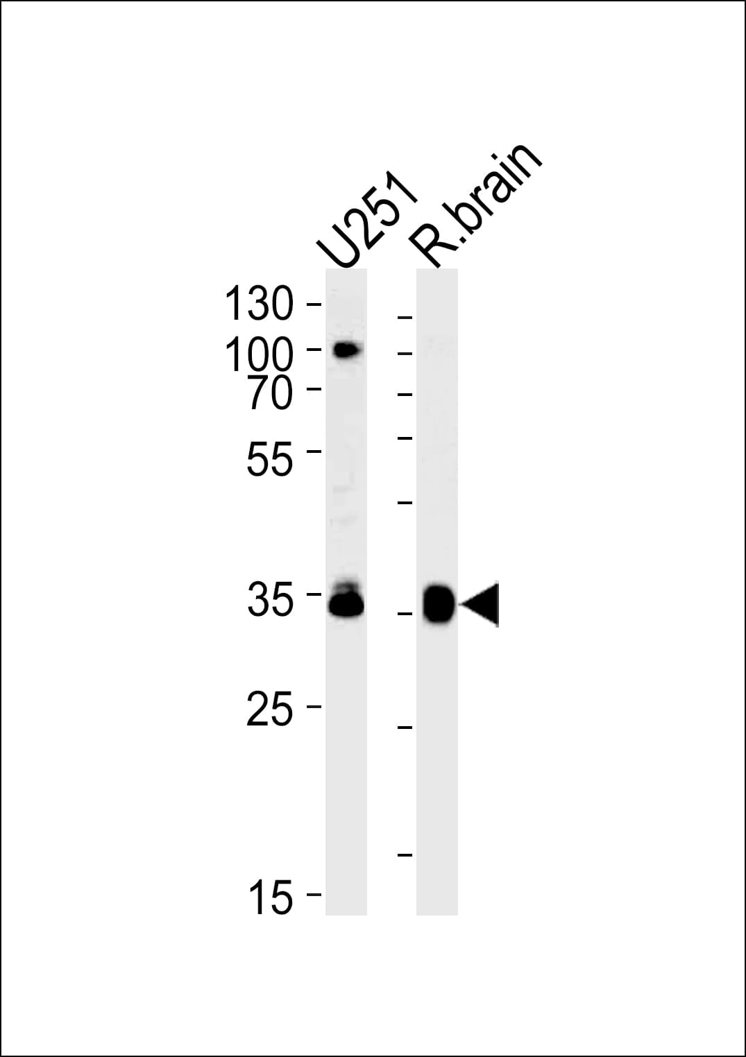 GNAO1 Antibody (aa291-320)