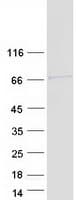 Human PPP1R16A Protein (Recombinant Myc-DDK (Flag))