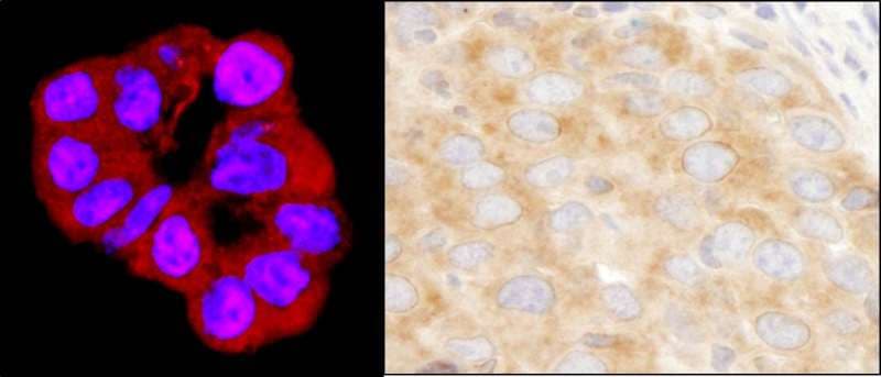DDX3 / DDX3X Antibody (aa1-50)