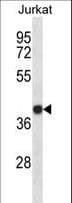 IHC-plus™ SET / TAF-I Antibody (aa47-75)