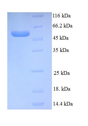 Human ESR2 / ER Beta Protein (Recombinant His)