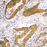 Polyclonal Rabbit anti-Human USP48 Antibody (Internal, IHC, WB)