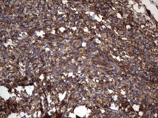 KRT7 / CK7 / Cytokeratin 7 Antibody (clone OTI2A2)
