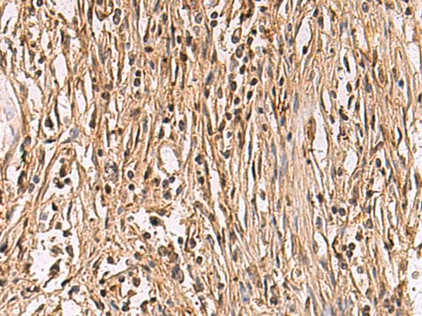 CD39 Antibody