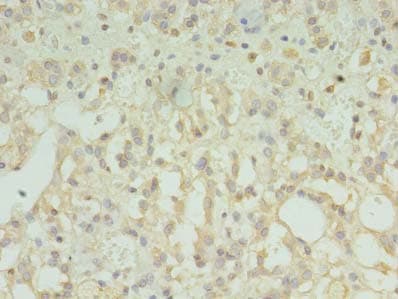 Polyclonal Rabbit anti-Human TMEM33 Antibody (IHC)