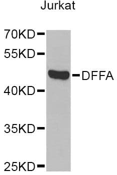 DFFA / ICAD / DFF45 Antibody