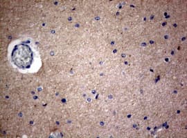 VILIP / VSNL1 Antibody (clone OTI7D6)