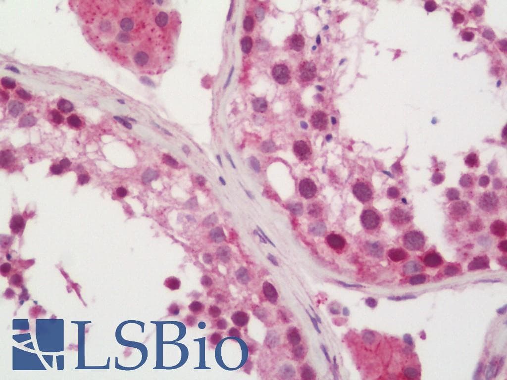 IHC-plus™ NUP210 / gp210 Antibody