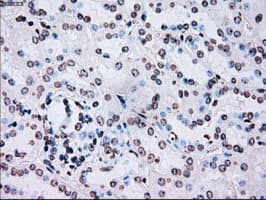 PLK1 / PLK-1 Antibody (clone OTI1D4)
