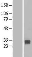 CLEC4D / MCL Protein (Over-Expression Lysate Myc-DDK (Flag))