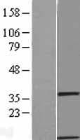 GIMAP1 Protein (Over-Expression Lysate Myc-DDK (Flag))