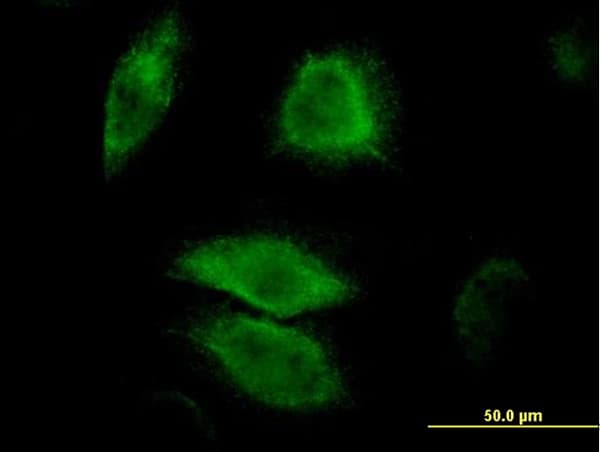 IHC-plus™ DUSP6 / MKP3 Antibody (clone 3G2)