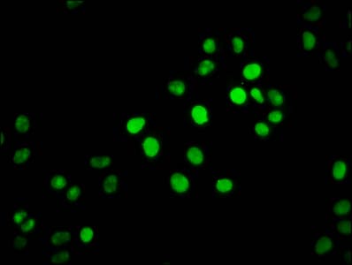 HIST1H2BN Antibody