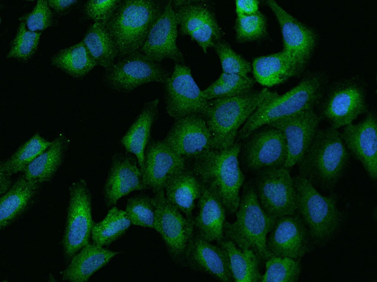IFNAR1 / IFNAR Antibody