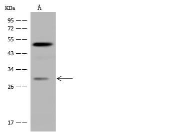 CIDEA / CIDE-A Antibody