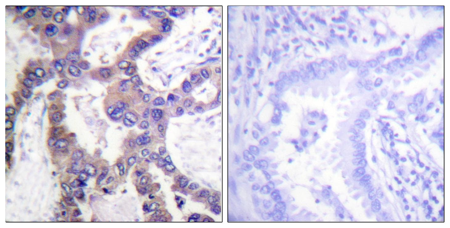 DUSP1 / MKP1 Antibody (phospho-Ser359)